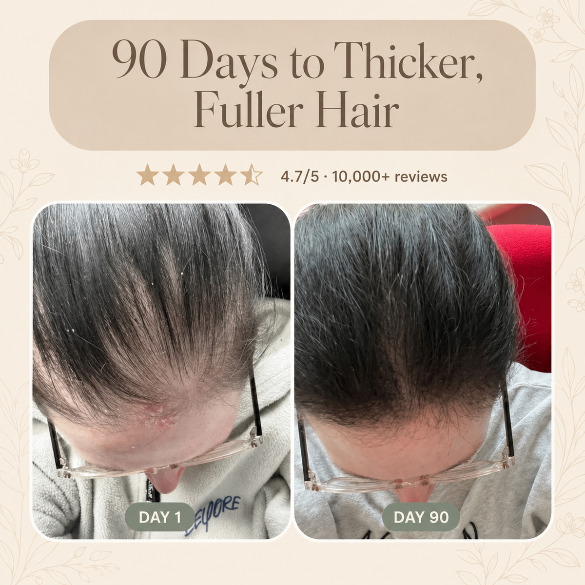 Korean Scalp Ritual Bar